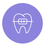 Dental Braces