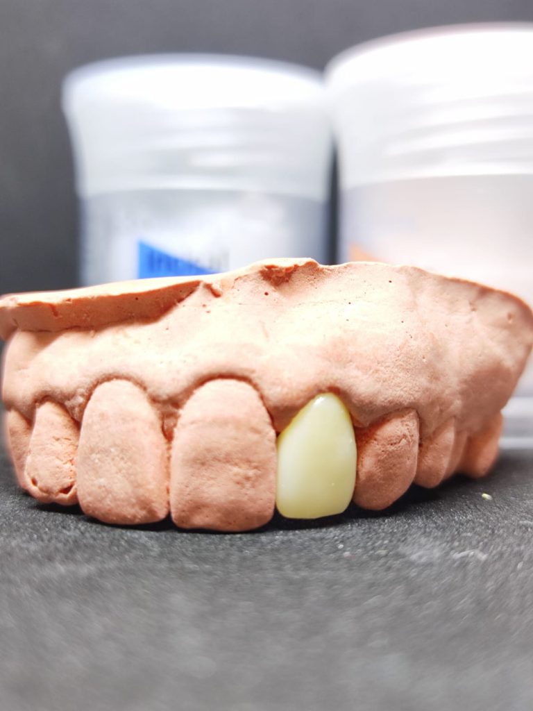 lab preparation of dental crown